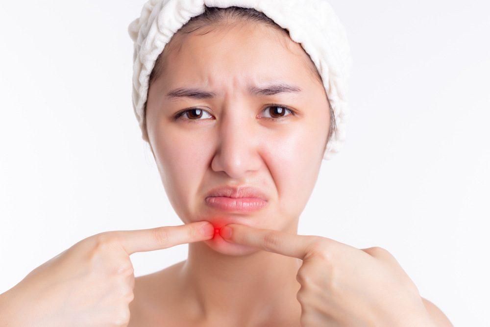 ผิวไหม้แดด ผิวดำคล้ำ แก้ยังไงดี