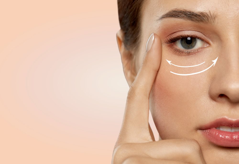 A woman corrects droopy eyes with aesthetic treatments