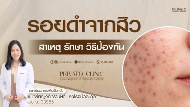 รอยดำจากสิว