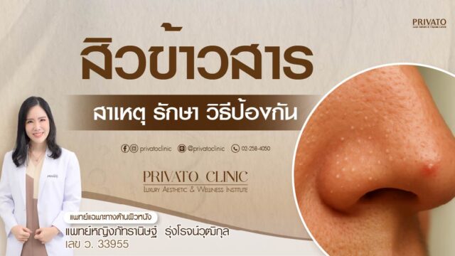 สิวข้าวสารบนจมูก