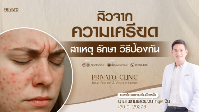 สิวจากความเครียดบนใบหน้ากับการรักษาสิว การป้องกันและปัญหาสิว