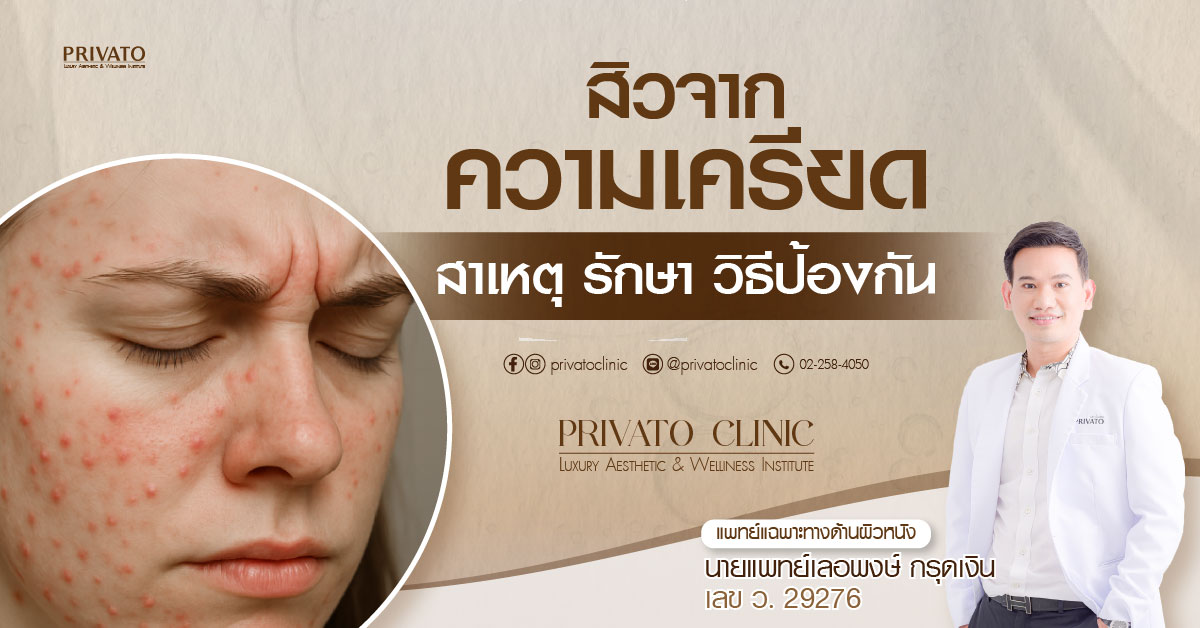 สิวจากความเครียดบนใบหน้ากับการรักษาสิว การป้องกันและปัญหาสิว