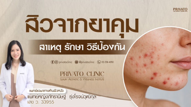 สิวจากยาคุมลักษณะอักเสบบริเวณใบหน้า