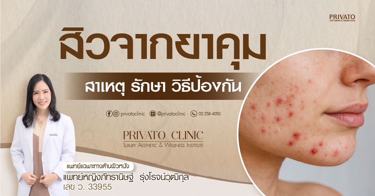 สิวจากยาคุมลักษณะอักเสบบริเวณใบหน้า