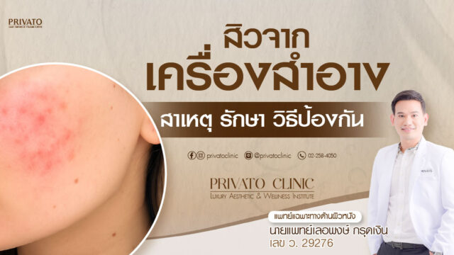 ผิวที่เป็นสิวโดยเกิดจากเครื่องสำอาง