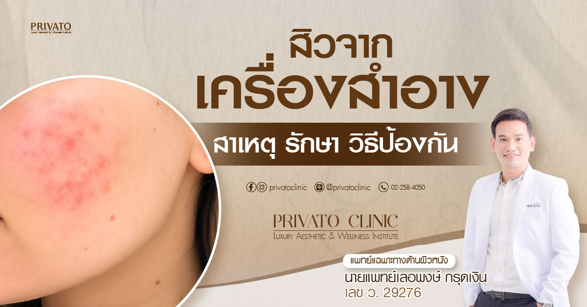 ผิวที่เป็นสิวโดยเกิดจากเครื่องสำอาง