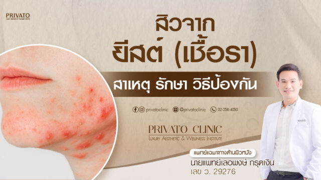 สิวจากยีสต์ เชื้อรา และผดผื่น คอและใบหน้าที่อักเสบ