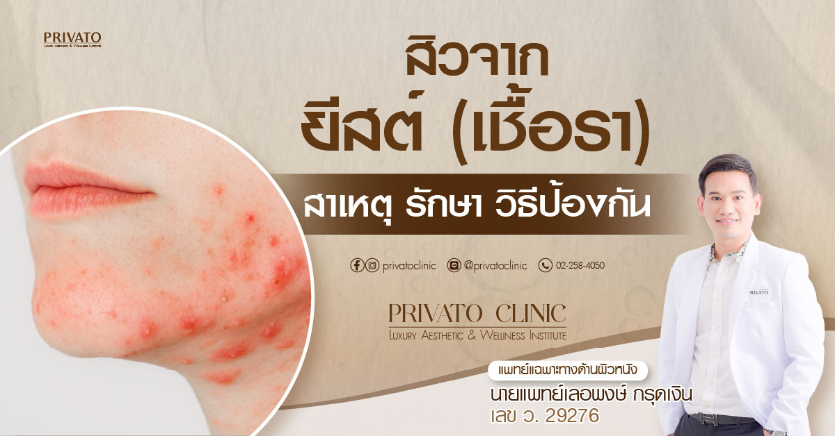 สิวจากยีสต์ เชื้อรา และผดผื่น คอและใบหน้าที่อักเสบ