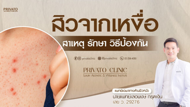 สิวจากเหงื่อ