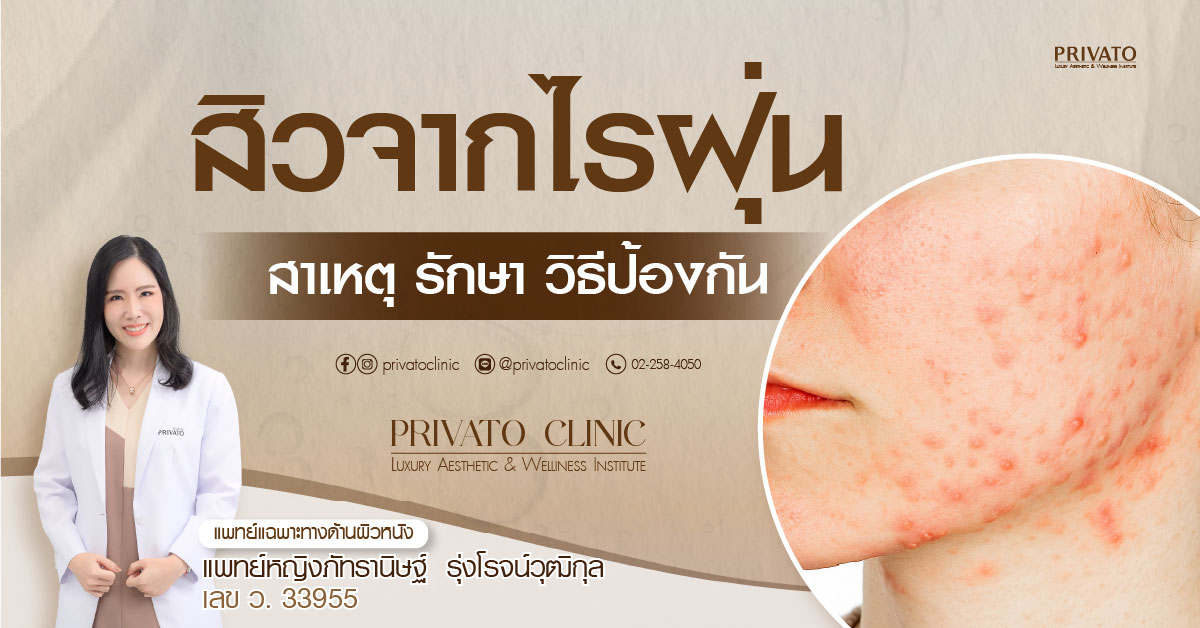 ใบหน้าที่เป็นสิวและรอยแดงจากไรฝุ่น