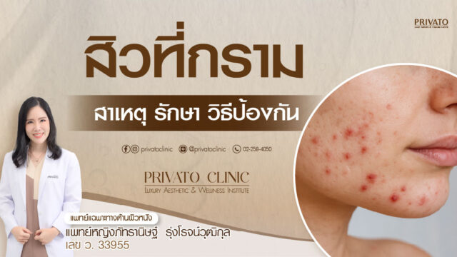 สิวที่กราม สาเหตุ วิธีรักษา และการป้องกันอย่างไรให้ได้ผล