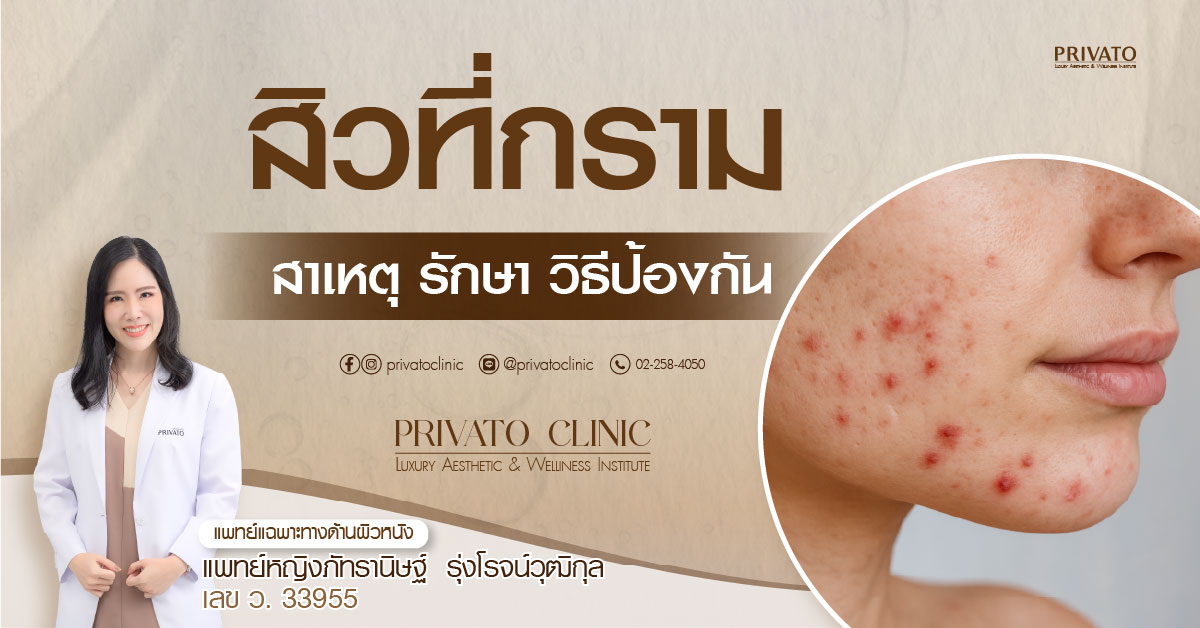 สิวที่กราม สาเหตุ วิธีรักษา และการป้องกันอย่างไรให้ได้ผล