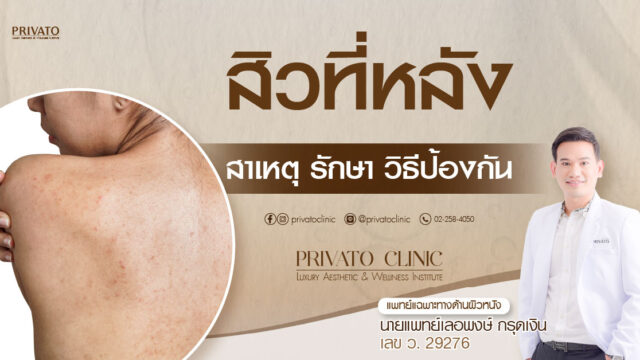 สิวที่หลัง สาเหตุ การป้องกันที่ถูกวิธี