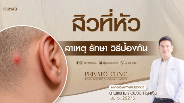 สิวที่หัว การเป็นสิวบนหนังศีรษะ และสาเหตุ วิธีรักษา การป้องกันอย่างถูกวิธี