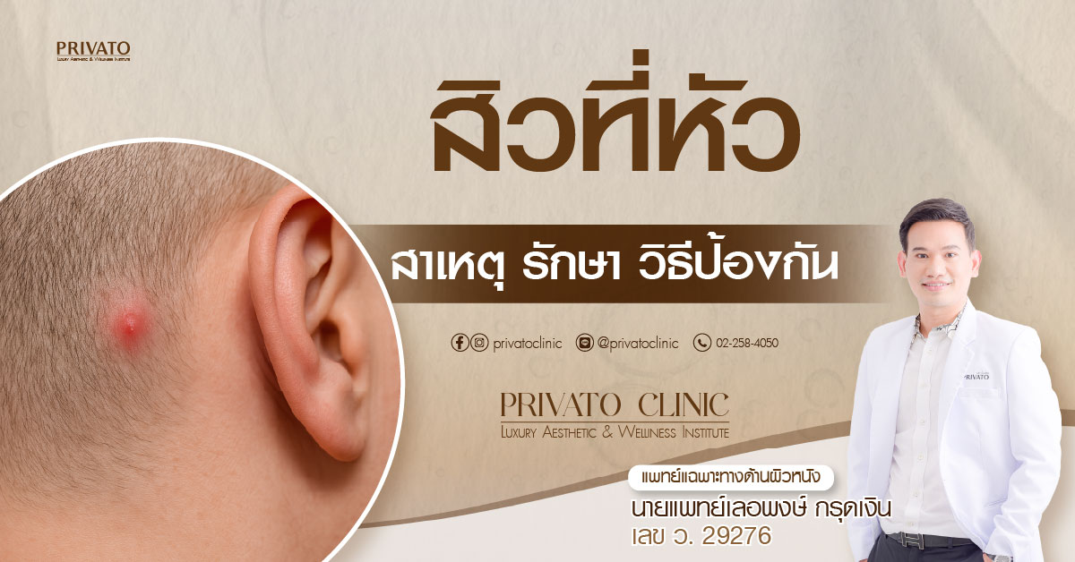 สิวที่หัวบริเวณใกล้ตำแหน่งหู