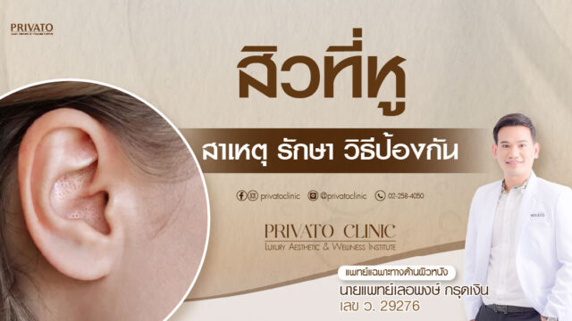สิวที่หู สาเหตุ การรักษา และวิธีป้องกัน