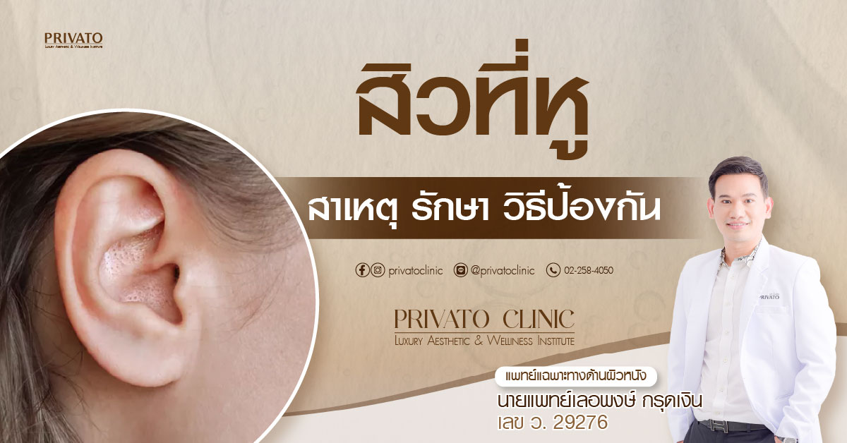 สิวที่หู สาเหตุ การรักษา และวิธีป้องกัน