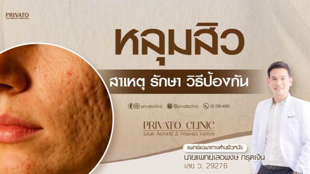 หลุมสิวเกิดขึ้นได้อย่างไรและรักษาแบบไหน