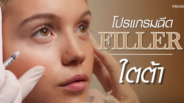 ฉีด fillerใต้ตา