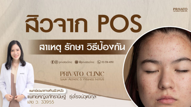 สิวจาก POS บริเวณใบหน้า