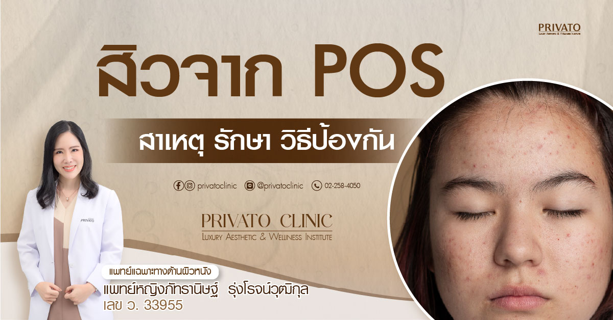 สิวจาก POS บริเวณใบหน้า