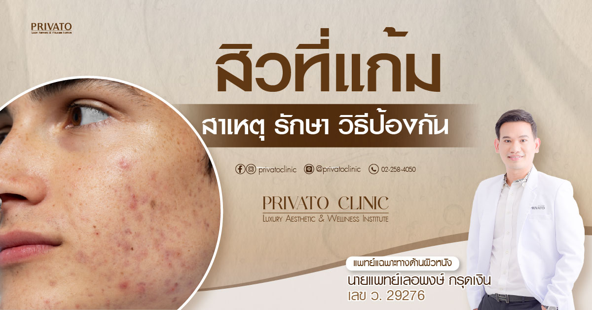 สิวที่แก้มด้านขวา