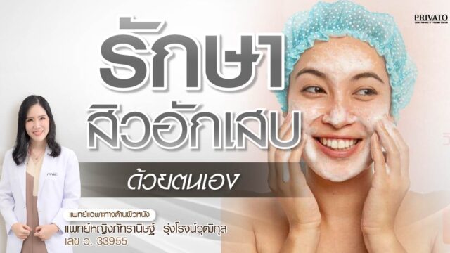 รักษาสิวอักเสบด้วยตัวเอง