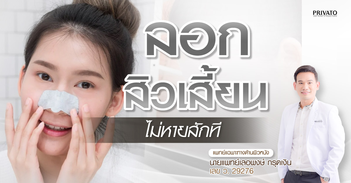 ลอกสิวเสี้ยน อย่างถูกต้องทำยังไง