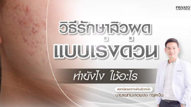 วิธีรักษาสิวผดแบบเร่งด่วนให้ได้ผล เพื่อให้หน้ากลับมาเนียนใส