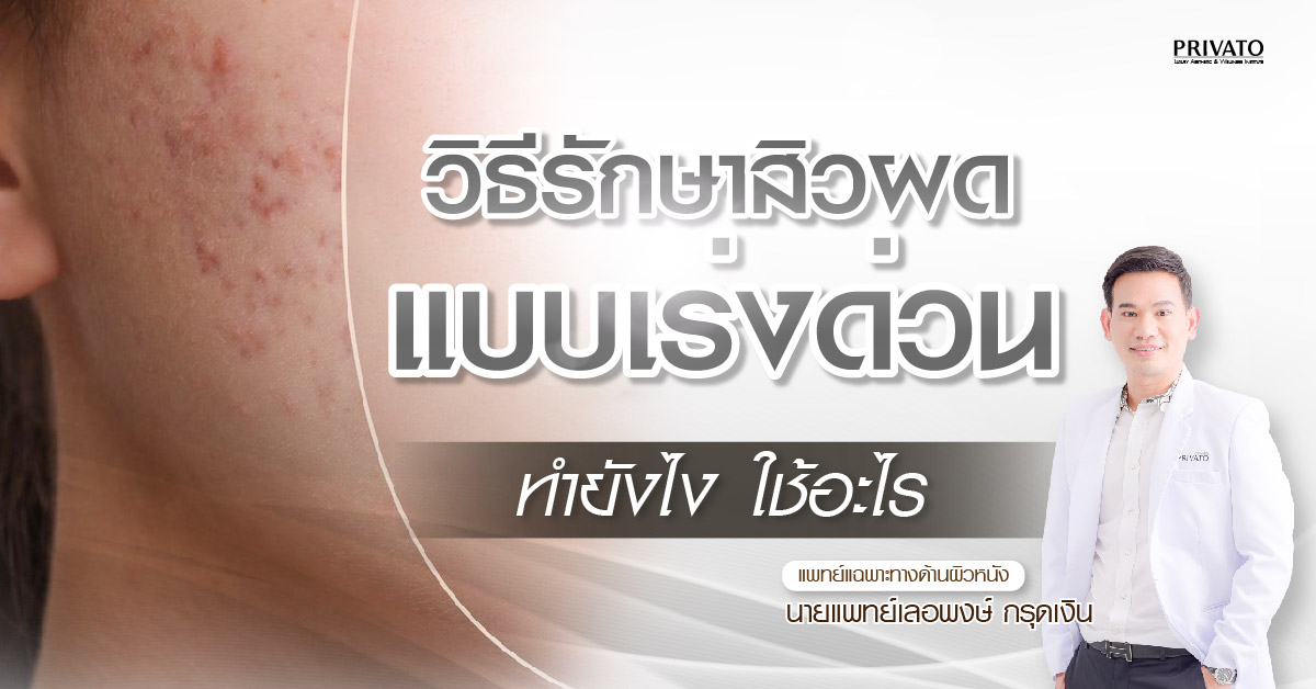 วิธีรักษาสิวผดแบบเร่งด่วนให้ได้ผล ทำยังไง ใช้อะไร