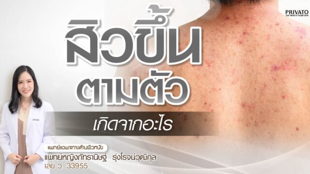 สิวขึ้นตามตัว ต้องทำอย่างไร