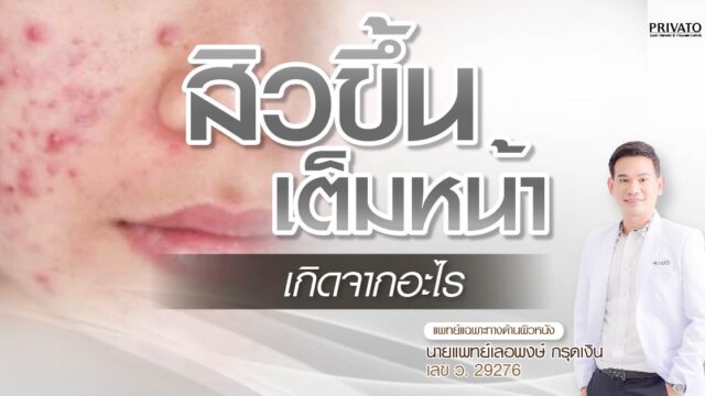 สิวขึ้นเต็มหน้าเกิดจากอะไร