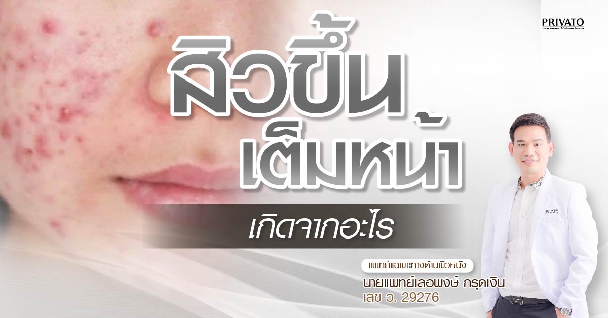 สิวขึ้นเต็มหน้าเกิดจากอะไร