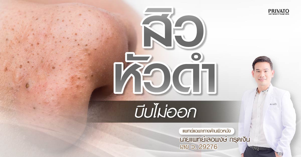 สิวหัวดํา บีบไม่ออก ต้องทำอย่างไรดี