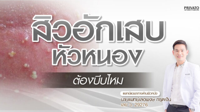 สิวอักเสบหัวหนอง ต้องบีบไหม