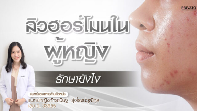 สิวฮอร์โมนในผู้หญิงรักษายังไง
