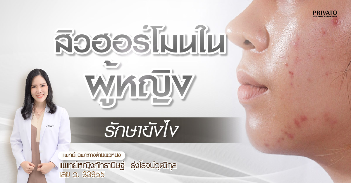 สิวฮอร์โมนในผู้หญิงรักษายังไง