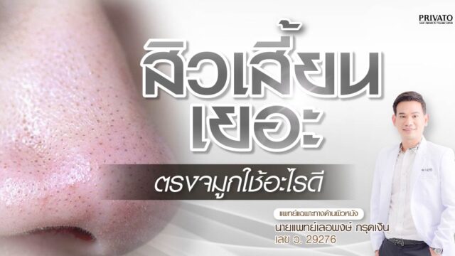 สิวเสี้ยนตรงจมูกใช้อะไรดี แก้ไขอย่างไรให้ตรงจุด