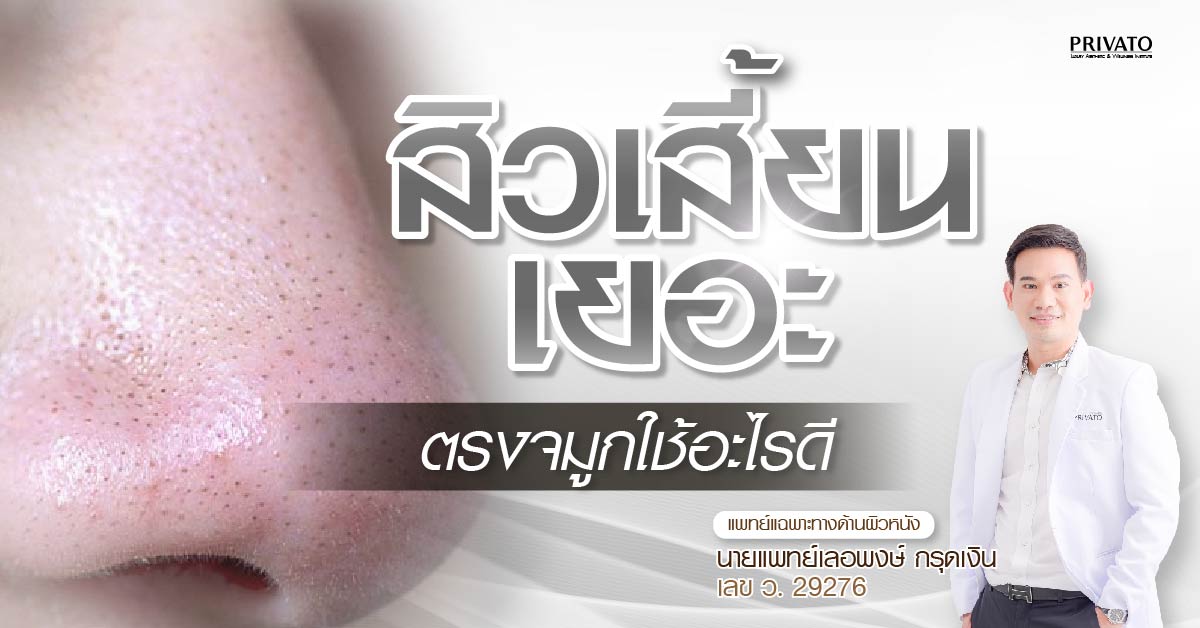 สิวเสี้ยนตรงจมูกใช้อะไรดี แก้ไขอย่างไรให้ตรงจุด