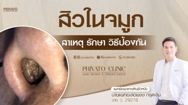 สิวในจมูก วิธีดูแลตัวเองขั้นพื้นฐาน