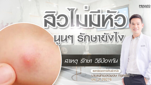 สิวไม่มีหัวนูนๆต้องรักษาอย่างไรให้ถูกวิธี