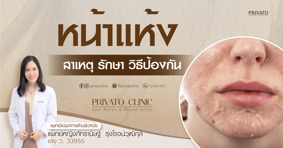 หน้าแห้ง