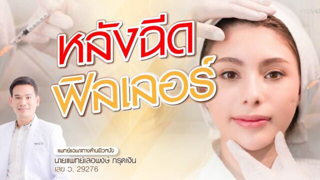 หลังฉีดฟิลเลอร์ ข้อห้ามและข้อควรปฏิบัติ