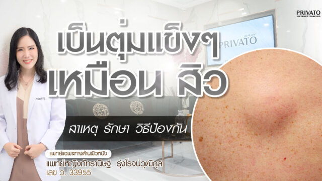 เป็นตุ่มแข็งเหมือนสิว