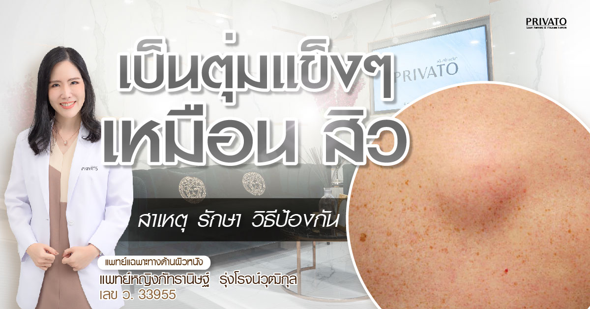 เป็นตุ่มแข็งเหมือนสิว