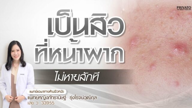 สิวที่หน้าผากไม่หายสักที เกิดจากอะไร แก้อย่างไรให้ตรงจุด