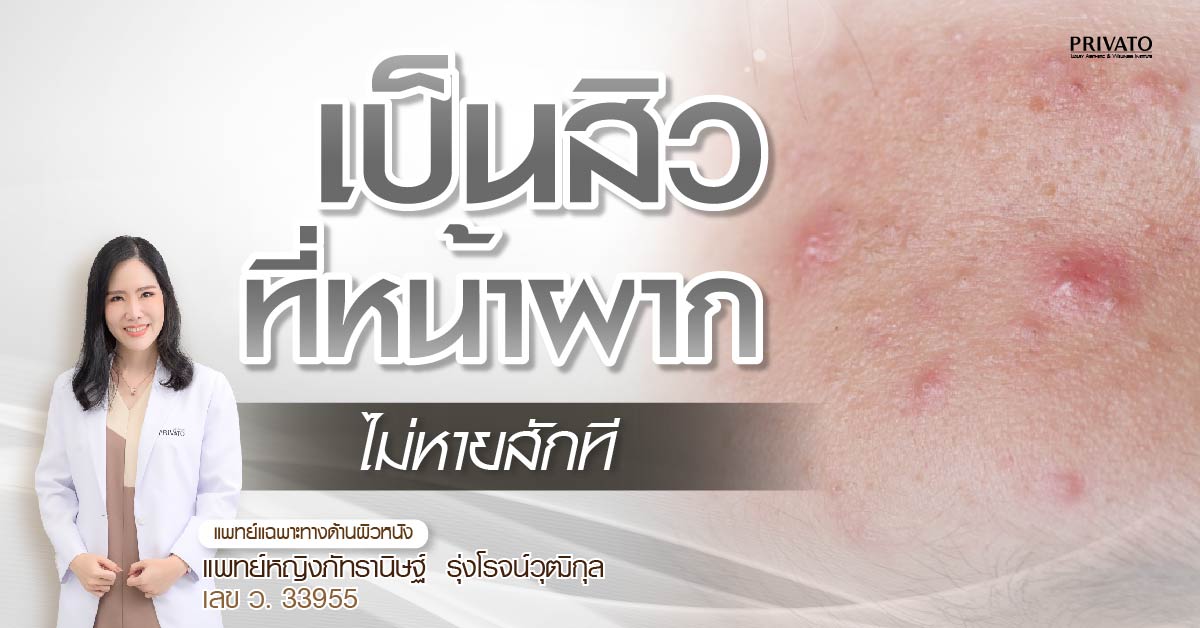 สิวที่หน้าผากไม่หายสักที เกิดจากอะไร แก้อย่างไรให้ตรงจุด