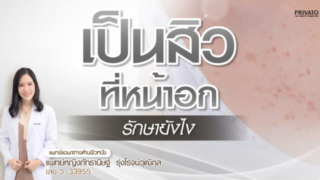 เป็นสิวที่หน้าอกรักษายังไง