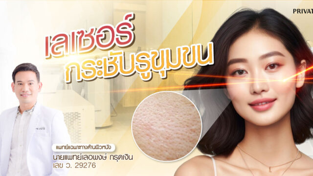 เลเซอร์กระชับรูขุมขนบนในหน้า
