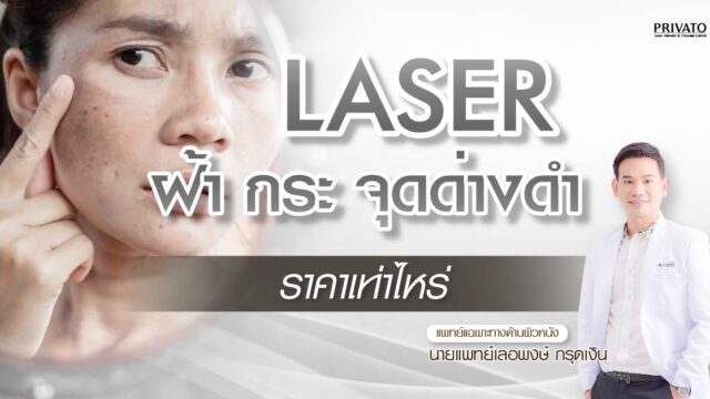 เลเซอร์ฝ้า กระ จุดด่างดำ ราคาเท่าไหร่? อัปเดต 2025